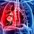 Akciğer kanseri tedavisi: Ameliyat, kemoterapi ve radyoterapi