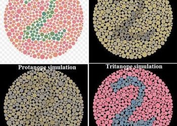 Renk körlüğü nedir? Neden olur? Belirtileri, testi ve tedavisi