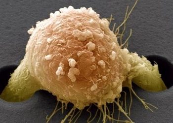 Kanser hücrelerini ‘tuzağa düşüren’ mikro bir cihaz geliştirildi