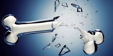 Vertebroplasti nedir? Omurga kırıklarını kemik çimentosu ile güçlendirilebilir