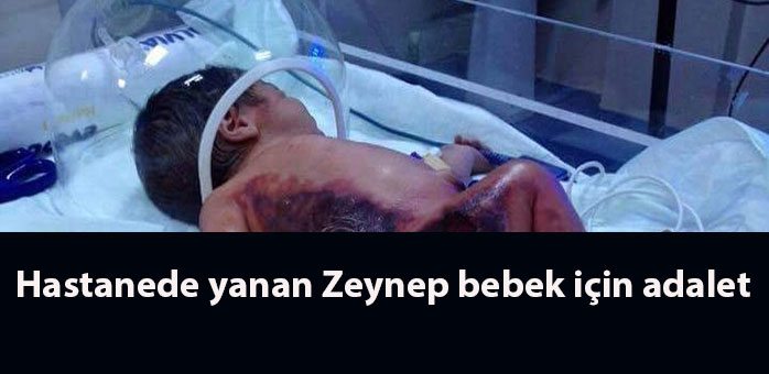 zeyenp-bebek-yanik2