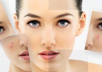 Cilt kızarıklığının nedeni nedir?