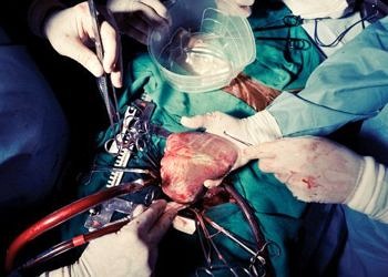 Açık kalp ameliyatı yapan cerrah nesli hızla tükeniyor!