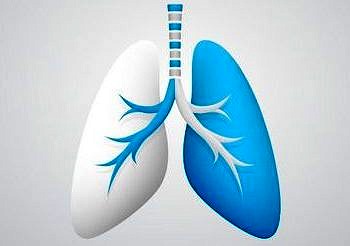 İdiopatik Pulmoner Fibrozis nedir? Kimlerde görülür? Belirtileri ve tedavisi
