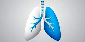 İdiopatik Pulmoner Fibrozis nedir? Kimlerde görülür? Belirtileri ve tedavisi