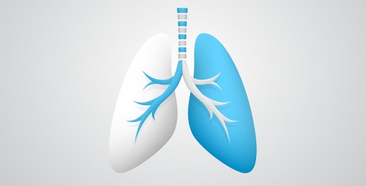 Idiopatik Pulmoner Fibrozis (IPF) Kanser kadar ciddi bir hastalık