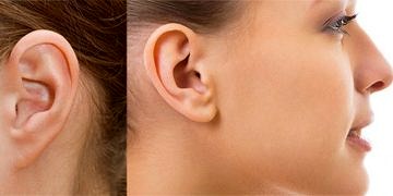 Yüz felcinde neden kulaklara dikkat etmek gerekiyor?