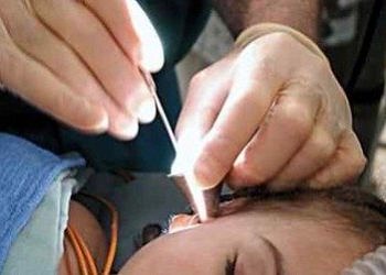 Kulak yıkanması ve kulak çubuğu kullanmak zararlı mı?