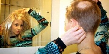 Saç koparma hastalığı nedenleri ve tedavisi