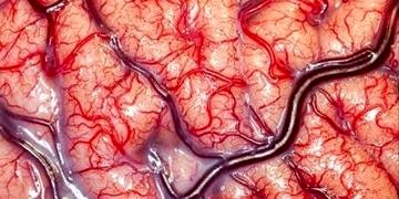 Kan-beyin bariyeri bu kez geçici delikler açılarak aşıldı