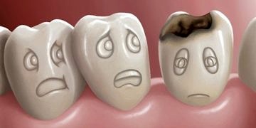 Diş çürükleri kalp hastalıklarına neden olabilir