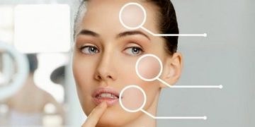 Kırışıklıklara hyaluronik asit tedavisi