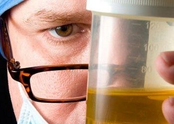 İdrarınızdaki değişiklikler ve kan görülmesi hangi hastalıkların habercisi