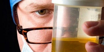 İdrarınızdaki değişiklikler ve kan görülmesi hangi hastalıkların habercisi