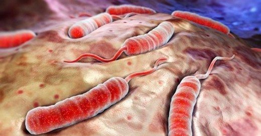 kolera-nasil-bulasir-belirtileri-tedavisi