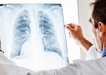 Sadece üşütmekle zatürre olunmaz! Kimler zatürre aşısı yaptırmalı?