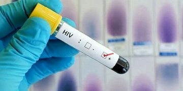 Türkiye AIDS raporu: 7 hastadan biri ev kadını, hastaların yarısı tedavi almıyor