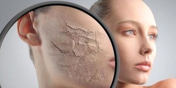 Soğuk havalarda cildinizi korumak için bu önerilere kulak verin