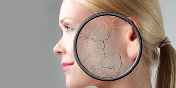 Cilt kuruluğuna ne iyi gelir