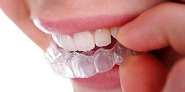 Diş gıcırdatma (bruksizm) neden olur? Belirtileri ve tedavisi