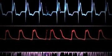 Kalp pili hack’lenebilir mi?