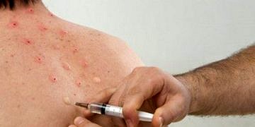 Geçmeyen ağrıların tedavisinde; nöral terapi