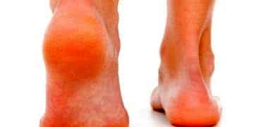 Topuk dikeni tedavisinde en etkili yöntem yenileyici enjeksiyon