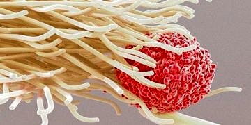 Bilim insanları MS hastalığına neden olan hücreleri tedavi etmeyi başardı