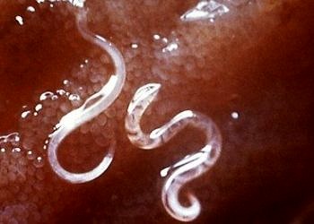 Kancalı kurt hastalığı, belirtileri, tanı ve tedavisi…