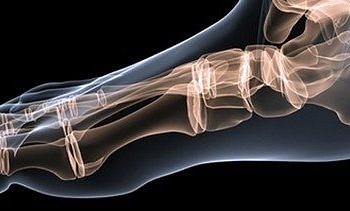 Kıkırdak hastalıklarının nedenleri ve tedavi yöntemleri