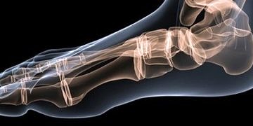 Kıkırdak hastalıklarının nedenleri ve tedavi yöntemleri