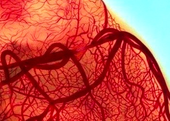 Periferik (Kol ve Bacak) damar tıkanıklıkları tanı ve tedavileri