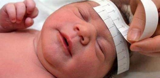 zika-ile-mikrosefali-arasinda-guclu-bag-var