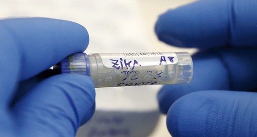 zika-virüsü-dna