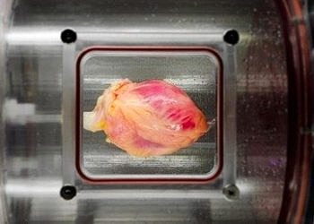 Donör kalp, kök hücrelerle donatılarak organ reddi engellenecek
