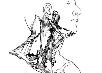 Hızlı kilo verme yöntemleri sağlığınıza ciddi zararlar verebilir!