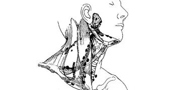 Hızlı kilo verme yöntemleri sağlığınıza ciddi zararlar verebilir!