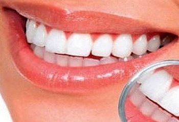 Diş çürümesini yavaşlatan bir bakteri türü keşfedildi