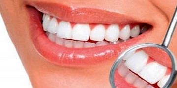 Diş çürümesini yavaşlatan bir bakteri türü keşfedildi