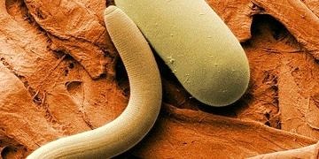 İnsan beyni ile solucan beyni arasında önemli benzerlikler saptandı