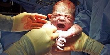 Küba anneden bebeğe HIV geçişini önlemeyi başardı