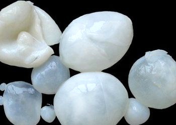 Kist hidatik nedir? Belirtileri ve tedavisi