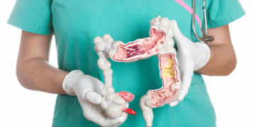 İnflamatuvar barsak hastalıklarının düzenli tedavisi, kanser riskini azaltıyor