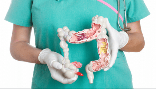 InflamatuasIltihabi-bagissak-hastaliklasi