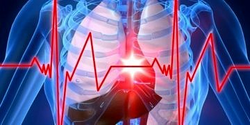 Aort damarı neden yırtılır? Korunmak için neler yapmak gerekir?