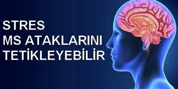 Stres, MS (Multipl Skleroz) ataklarını tetikleyebilir