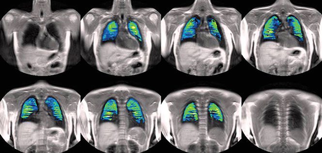 rotgen-mr-gogus-kanser