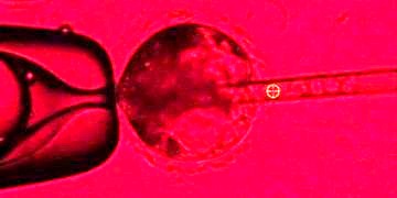 Domuz vücudunda insan organı yetiştirmek için bir adım daha