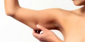 Sarkan yarasa kollara izsiz sıkılaştırma operasyonu