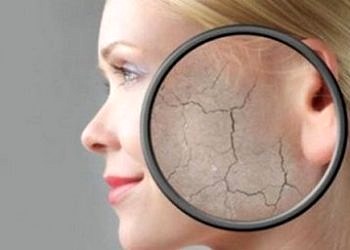 Cilt kuruluğunu önlemek için neler yapmalı?